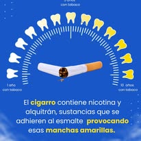 Consejo de cepillo dental